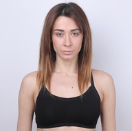 常维玲医生的技术如何？她有隆胸案例吗？