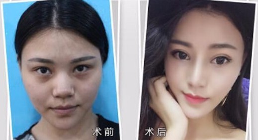 广州伊丽莎白整形医院怎么样?经典案例分享