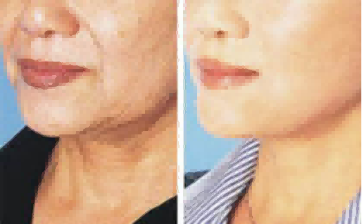 李文宏医生手术经验丰富吗？他做的怎么样？案例有吗？