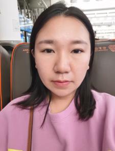 任向群医生擅长注射瘦脸的注射吗？附三个月的前后对比图