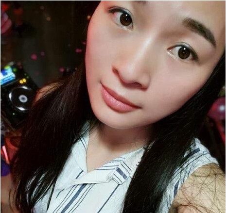 温州加美整形医院技术如何?有没有案例分享?