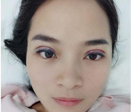 温州加美整形医院技术如何?有没有案例分享?