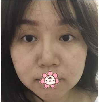 北京美联臣医院怎么样?医院有没有案例分享?