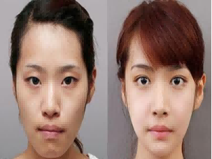 广西整形医院哪家好？有什么特色？有案例支持