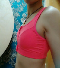 王志医生隆胸手术怎么样?他在哪家医院工作?