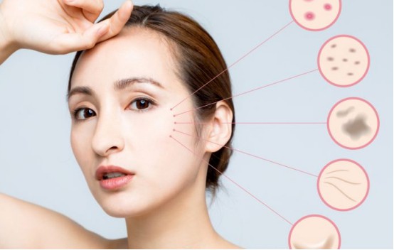 光子嫩肤多久做一次果较好?有什么需要注意的?