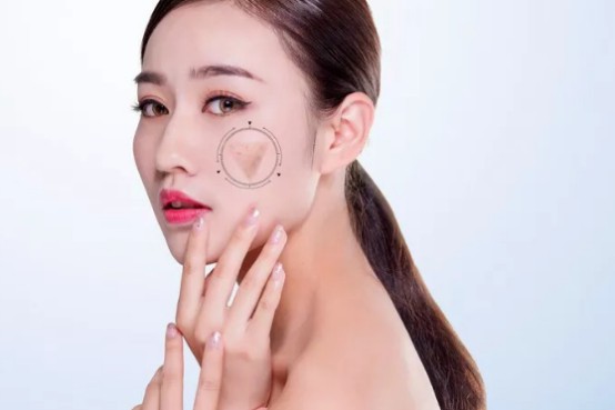 光子嫩肤多久做一次果较好?有什么需要注意的?