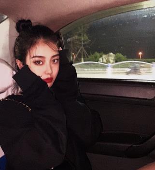 刘丽娜医生的技术怎么样？附眼部整形恢复过程