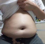 水动力环吸吸脂好不好?吸脂案例分享-----价格