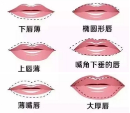 肖秀丹医生怎么样?她的唇形手术做的怎么样?手术案例有吗?