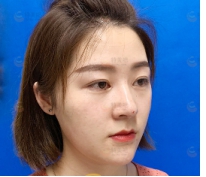 太原欧美莲整形医院好不好?经典案例分享