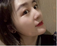 太原欧美莲整形医院好不好?经典案例分享