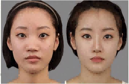 中日友好医院怎么样?中日友好医院案例分享