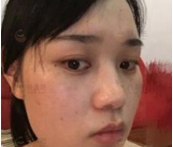 顾浩医生技术如何？顾浩医生案例分享