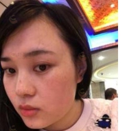 顾浩医生技术如何？顾浩医生案例分享