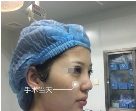 武汉卓美整形医生有哪些?医院有什么案例分享?