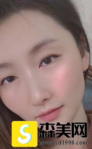 李志海的玻尿酸填充手术怎么样?附果图浏览