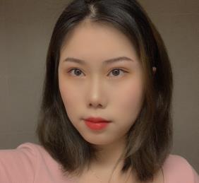 上海李湘源医生双眼皮果图好吗?手术70天对比图