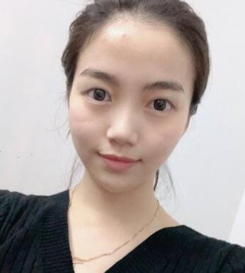 段小兵医生怎么样?段小兵医生案例分享