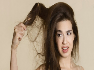 武汉恩吉娜的廖静医生的植发际线要多少?附植发案例和较新植发价目表