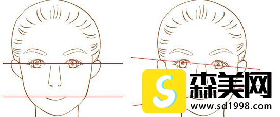 何锦泉医生的面部不对称矫正案例,果怎么样?