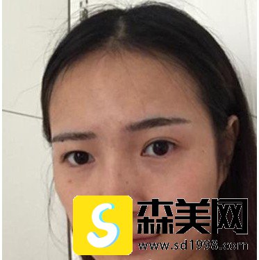 何锦泉医生的颌面技术实力和相关案例展示!