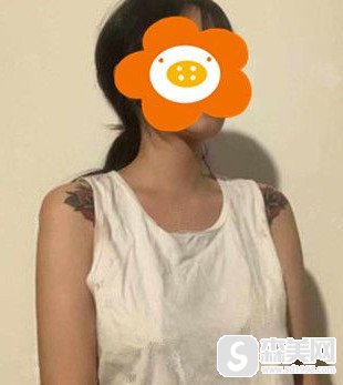 看到侍美网胸部整形的案例分享给了我什么样的改变?