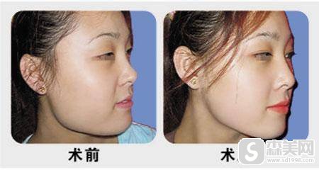 刘祥厦医生怎么样？刘祥厦医生案例