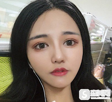 广东美恩整形美容医院好不好?广东美恩整形美容医院整容手术案例