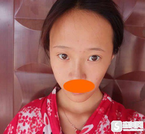 亚韩整形医院整形医师聂云飞怎么样?