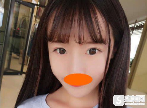 亚韩整形医院整形医师聂云飞怎么样?