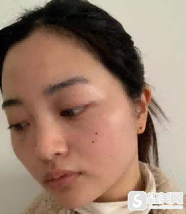 何照华医生怎么样?何照华医生案例