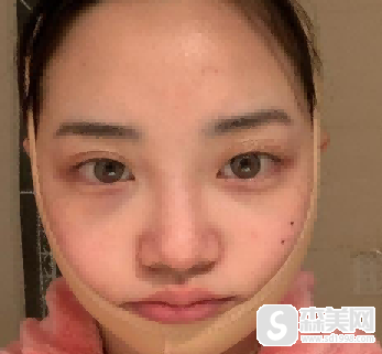 何照华医生怎么样?何照华医生案例