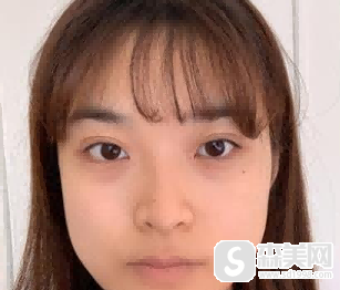 北京做正颌好的医生安利：北京联合丽格何照华必须要知晓！