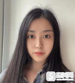 清远华康医院可以做双眼皮吗?果图浏览