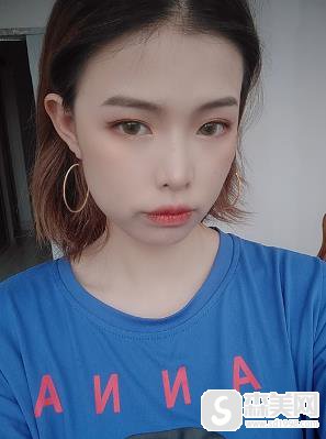 去脸颊脂垫恢复后，成功告别婴儿肥，重庆西南整形科前后对比照片