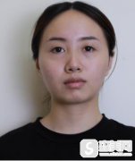 在北京八大处完成了瑞蓝丽缇打下巴果，附恢复图