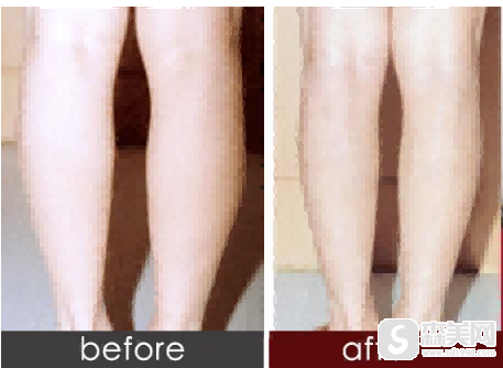 金尚训医生怎么样呀?金尚训医生案例介绍