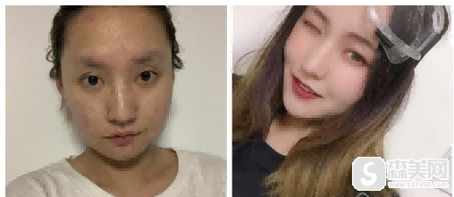 北京圣嘉荣医疗美容医院怎么样?北京圣嘉荣医疗美容医院案例介绍