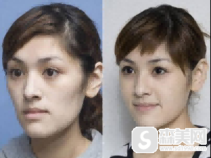 李佳融医生怎么样？李佳融医生案例展示