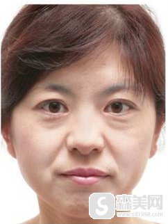 沈阳杏林整形外科医院怎么样?有案例分享吗?