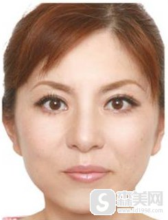 沈阳杏林整形外科医院怎么样?有案例分享吗?