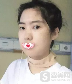 四川省人民医院医疗集团友谊医院好不好？四川省人民医院医疗集团友谊医院案例