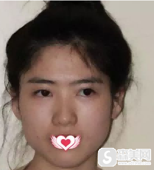 四川省人民医院医疗集团友谊医院好不好？四川省人民医院医疗集团友谊医院案例