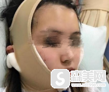 颌面医生卫国强整形技术如何?案例分析