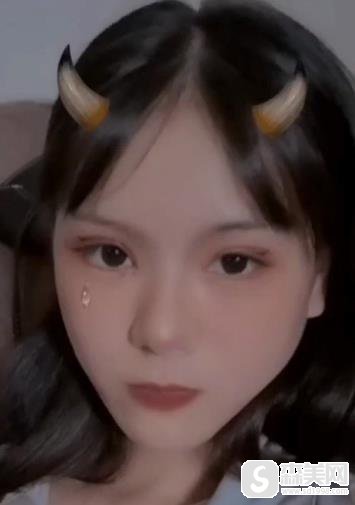 整形医生赵宇的双眼皮手术果?手术前后对比图