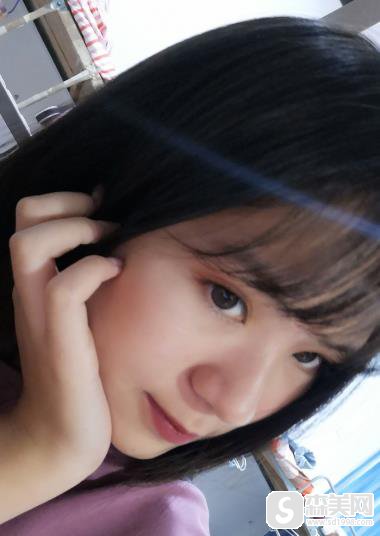 整形医生赵宇的双眼皮手术果?手术前后对比图