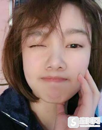 郑州大学第一附属医院面部脂肪填充详情,整形科填充对比图一览