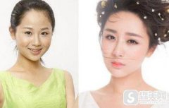 没想到真的在上海九院做到了锥子脸网络红人，超赞