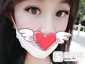 广州佳和医院做的眼部整形手术好不好?案例分享